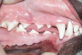 FAST FACTS: Stages of Dental Disease